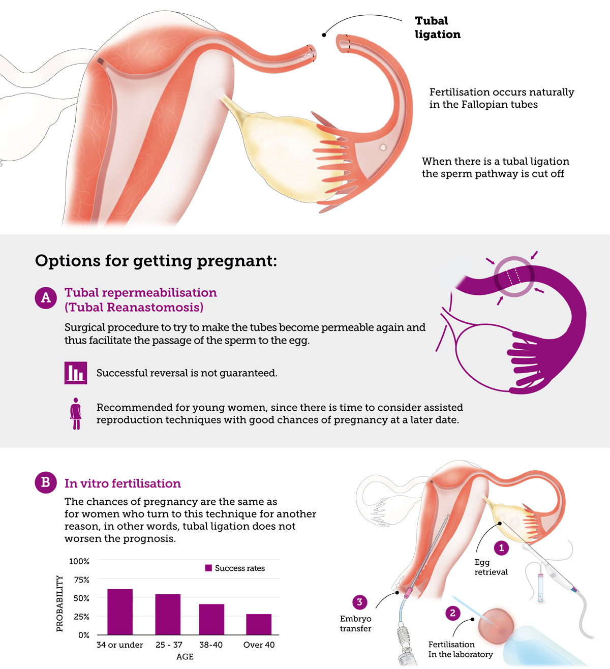 инфографика о шансах забеременеть при стерилизации маточных труб